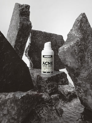 Transform Your Skin: The Power of Acne Serums